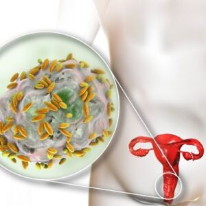 vaginal microbiome testing